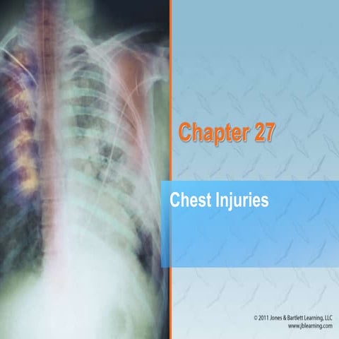 CHEST TRAUMA-1.pptxhdbbdnznanjwinajcigkkgktk | PPTX