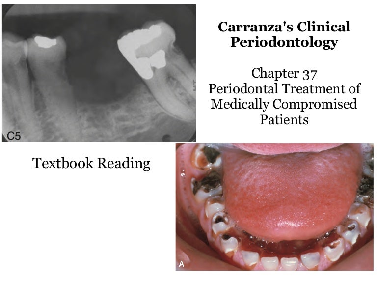 Periodontal Treatment of Medically Compromised Patients