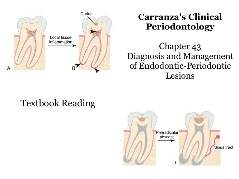 Diagnosis and Management of EndodonticPeriodontic Lesions