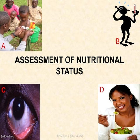 Chapter_8 Nutritional Assessment.pptx doft
