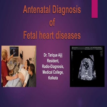 Antenatal Diagnosis of Fetal Heart Disease