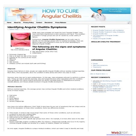 Angular Cheilitis Treatment | PDF