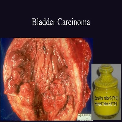 Chemical biologicalcarcinogens csbrp