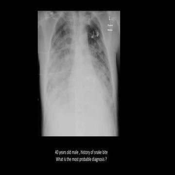 The radiology assistant chest x ray - lung disease | PDF
