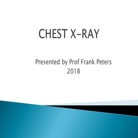 chest-x-ray.zp162335.ppt