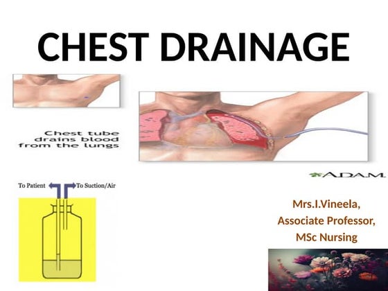 Chest tube insertion ppt (surgery) | PPTX