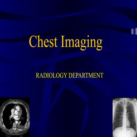 Chest imaging