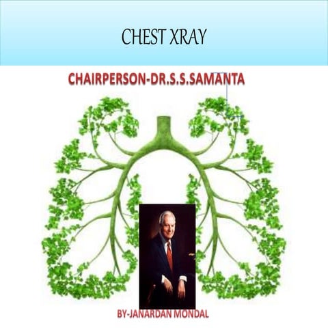 Chest imaging