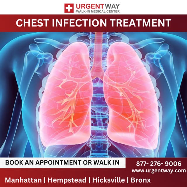 Chest Infection Treatment Chest Infection Treatment | PDF