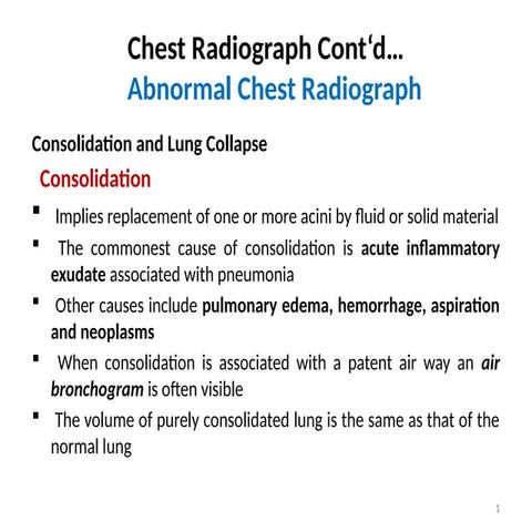 Chest Radiograph Course for medicine c-one and c-two students .pptx