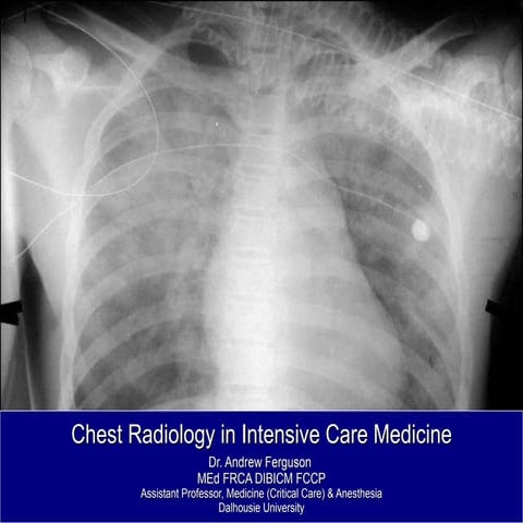 Chest radiology in intensive care