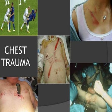 Chest Trauma.pptx