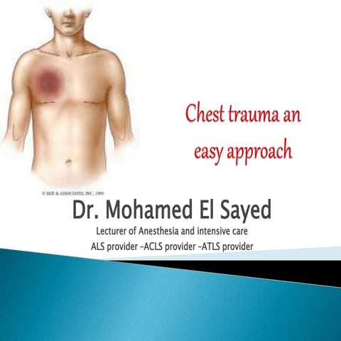 Chest trauma | PPTX