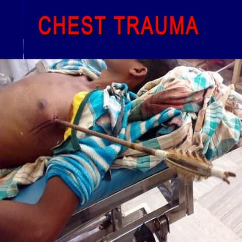 Chest trauma  presentation