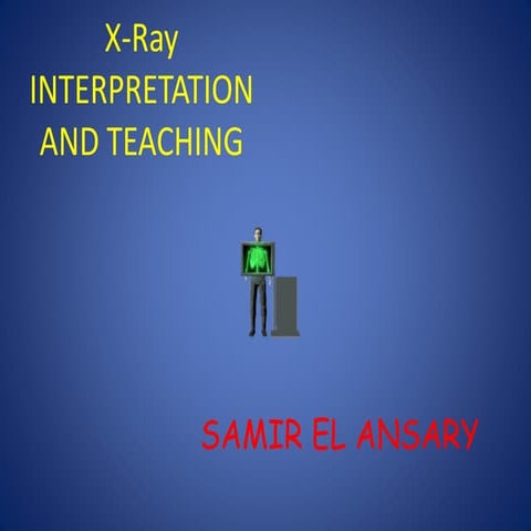 Chest x. ray interpretation and teaching
