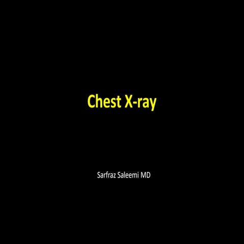 chestx-ray.pptx