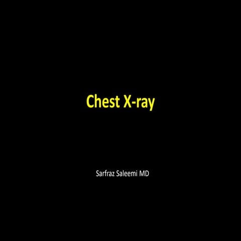 Chest X-ray Interpretation 