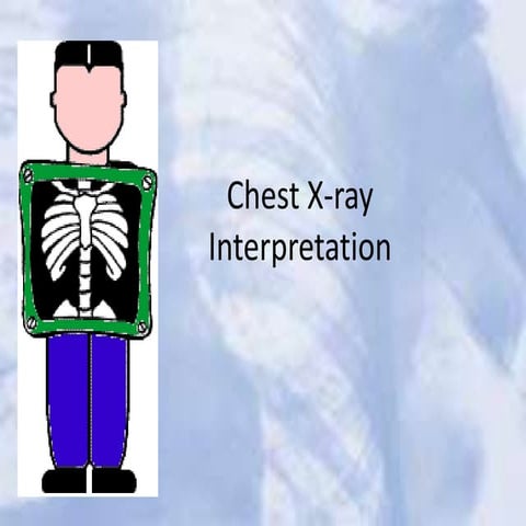 chestx-ray-180804183634.pdf