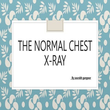chest x-ray.pptx