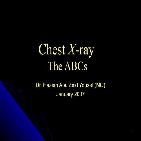Chest X-ray for the undergraduate