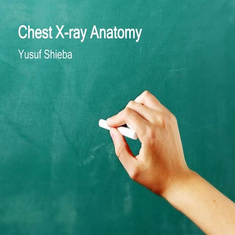 Chest x ray anatomy - how to interpret chest x-ray (2) | PPTX