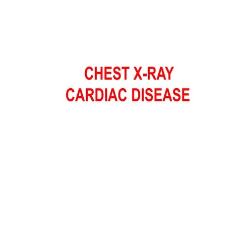 CHEST X-RAY CARDIAC DISEASE.........pptx