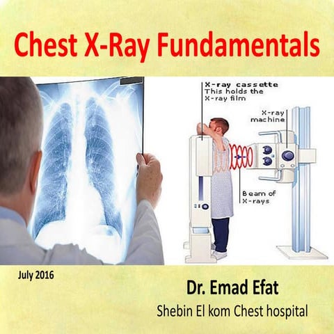 Chest X-ray Fundamentals on Acquisition and Interpretation.pdf