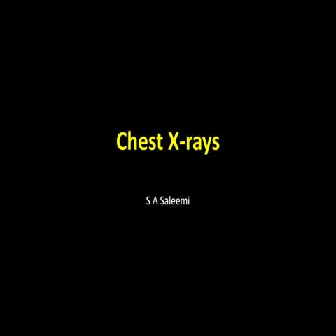 Chest X-ray Interpretation.pptx