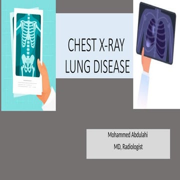 The radiology assistant chest x ray - lung disease | PDF