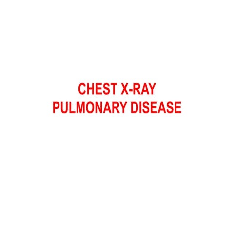 CHEST X-RAY PULMONARY DISEASE  pptx.pptx