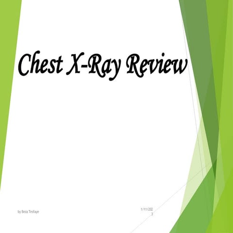 Chest X-Ray Review for 2nd year Radiology student.ppt