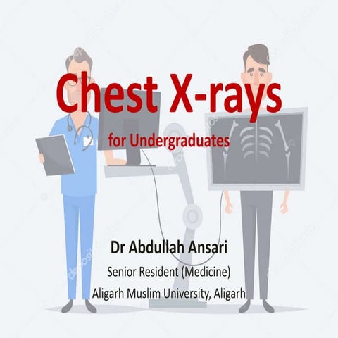 Chest X-rays for Undergraduates