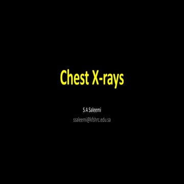 Chest X-ray Basics and Interpretation