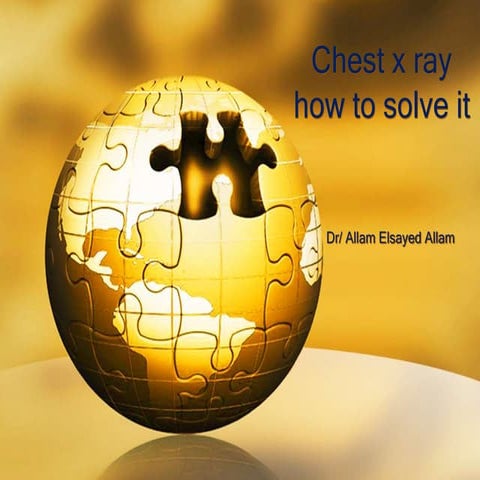 Chest x ray basic knowledge