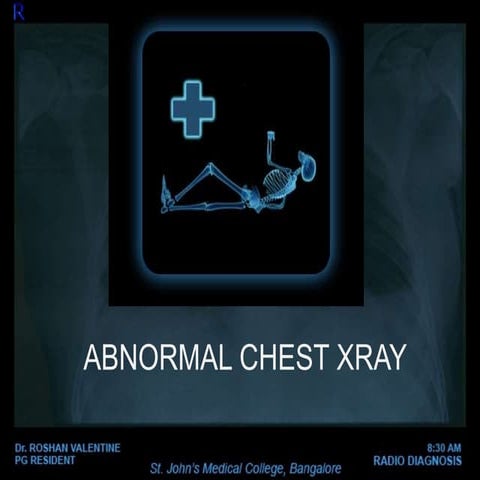 Abnormal Chest xray 