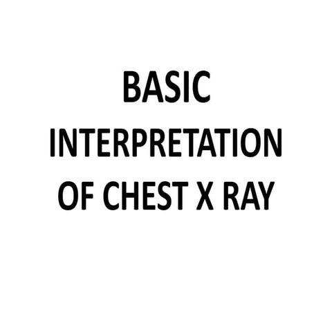 CHEST X-RAY