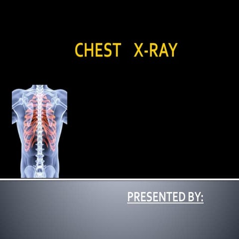 chest x ray 2.pptx