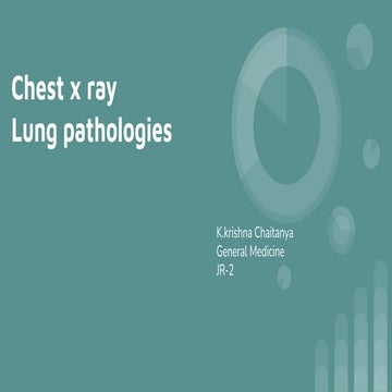 Chest x ray pathologies part one . (3) pdf