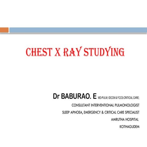 Chest X Ray interpretation Felson radiology.pptx