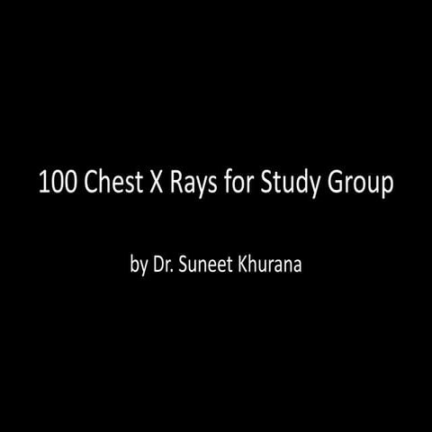 Chest X Rays