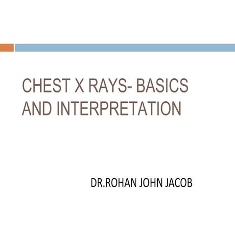 Basic chest x ray interpretation | PPT
