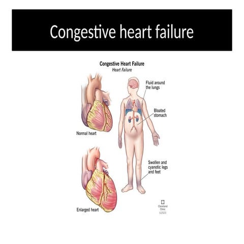 CHF PPT and heart failure classification.pptx