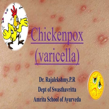 Chickenpox