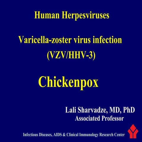 Chickenpox