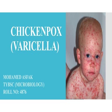 Chickenpox: Pathophysiology | PPTX