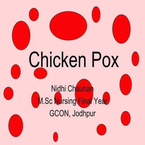 Chicken pox | PPT