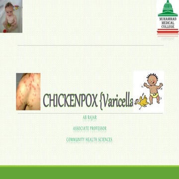  Epidemiology and control measures for CHICKENPOX {Varicella} 