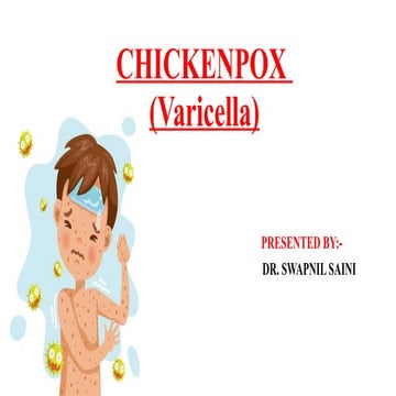 Chickenpox | PPT