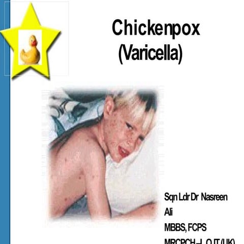 Chickenpox: Pathophysiology | PPTX