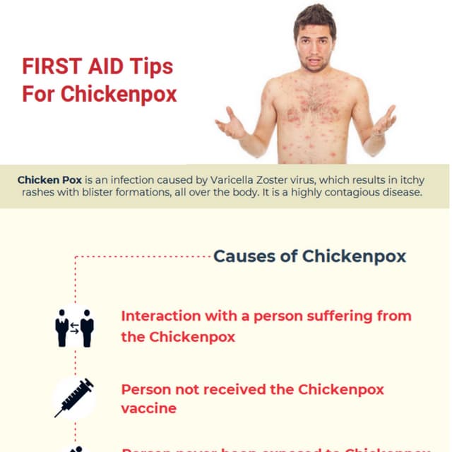 First Aid Tips for Chickenpox